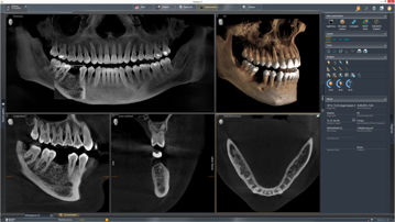 Mynd Orthophos S 3D röntgentæki
